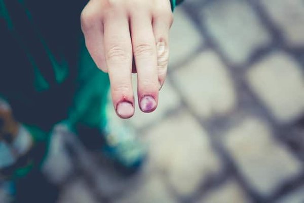 Wie reduziert man das Verletzungsrisiko durch körperliche Aktivität?